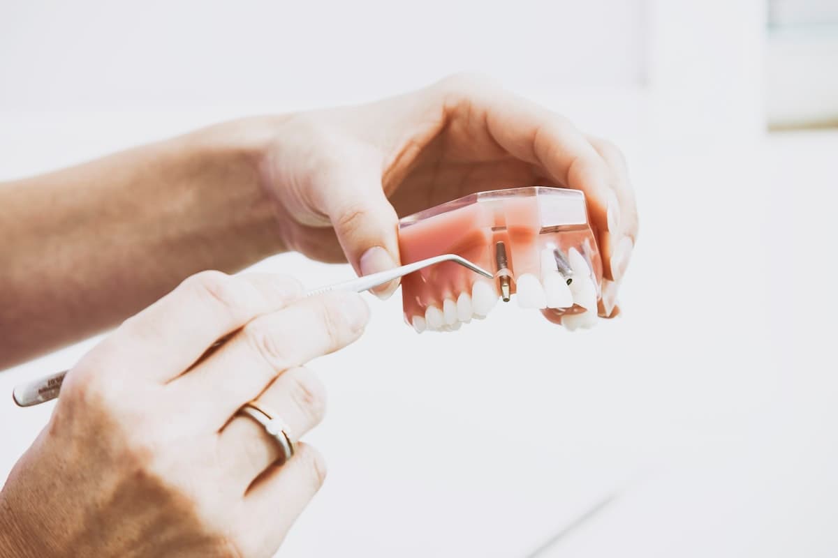 Dental prosthetic teeth on a model