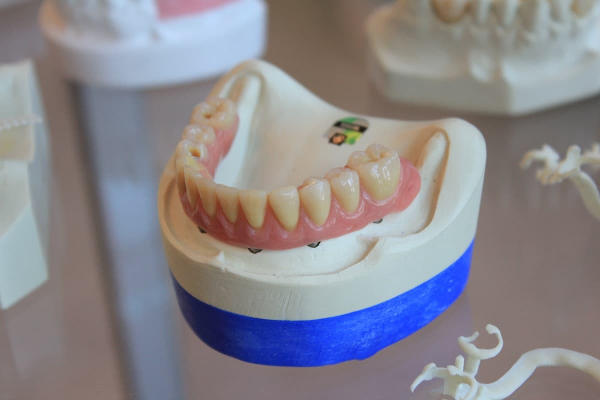 Dental implant model and components