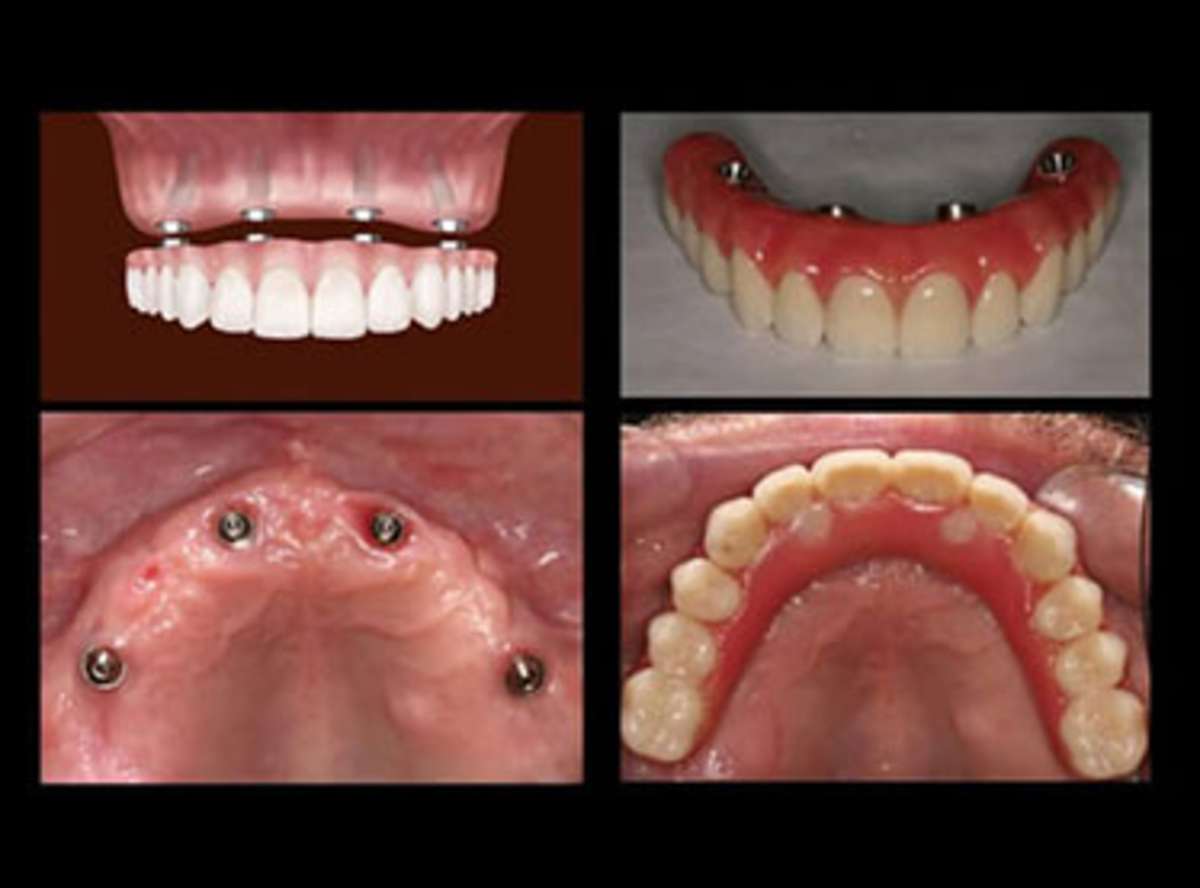 Recovery Timeline