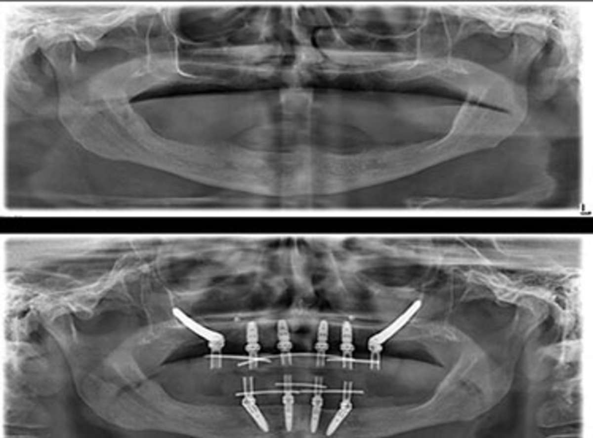 Oral Surgery