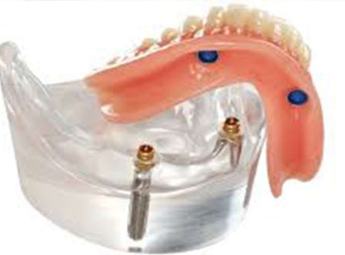 Prosthodontics & Dentures