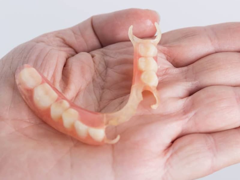 Implant Overdentures and Combination Cases